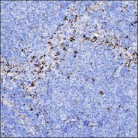Anti-MERTK antibody produced in rabbit HPA036196-100UL