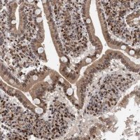 Anti-MESDC2 antibody produced in rabbit 
