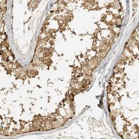 Anti-METTL12 antibody produced in rabbit HPA038533-100UL