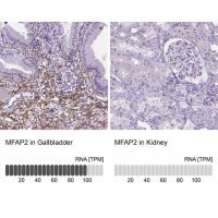 Anti-MFAP2 antibody produced in rabbit 