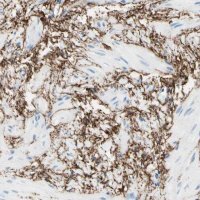 Anti-MFAP5 antibody produced in rabbit 