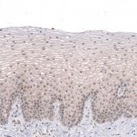Anti-MGA antibody produced in rabbit 