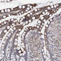 Anti-MGLL antibody produced in rabbit 