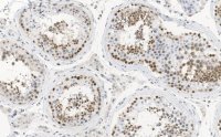 Anti-MGMT Antibody, clone 2N19 ZooMAb� Rabbit Monoclonal 