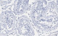 Anti-MGMT Antibody, clone 2N19 ZooMAb� Rabbit Monoclonal 