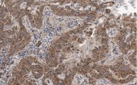 Anti-MICB Antibody, clone 2K9 ZooMAb� Rabbit Monoclonal 