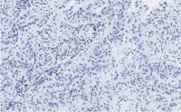 Anti-MICB Antibody, clone 2K9 ZooMAb� Rabbit Monoclonal 