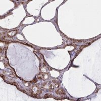 Anti-MINOS1 antibody produced in rabbit 