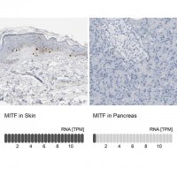 Anti-MITF antibody produced in rabbit