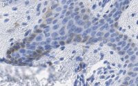 Anti-MITF Antibody, clone 1E2 ZooMAb� Rabbit Monoclonal 