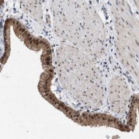 Anti-MKNK2 antibody produced in rabbit 