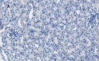 Anti-MLKL Antibody, clone 3F13, ZooMAb� Rabbit Monoclonal 