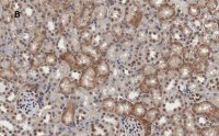 Anti-MLKL Antibody, clone 3F13, ZooMAb� Rabbit Monoclonal 