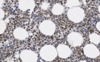 Anti-MMP-9 Antibody, clone 8H12 ZooMAb® Rabbit Monoclonal