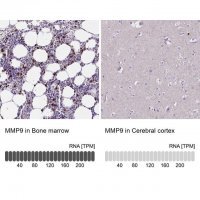 Anti-MMP9 antibody produced in rabbit 