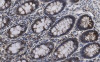 Anti-Mn-SOD Antibody, clone 1C14 ZooMAb� Rabbit Monoclonal 