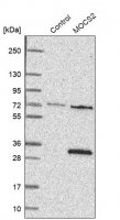 Anti-MOCS2 antibody produced in rabbit HPA037679-100UL