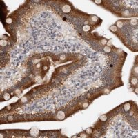 Anti-MOGAT2 antibody produced in rabbit 
