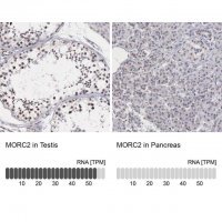 Anti-MORC2 antibody produced in rabbit