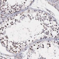 Anti-MORC2 antibody produced in rabbit