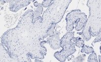 Anti-MOSPD2 Antibody, clone 3C20 ZooMAb� Rabbit Monoclonal 