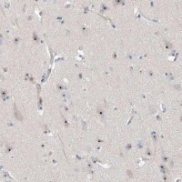 Anti-MPHOSPH10 antibody produced in rabbit