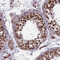 Anti-MPHOSPH8 antibody produced in rabbit
