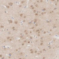 Anti-MPP2 antibody produced in rabbit 