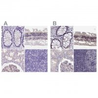 Anti-MPP5 antibody produced in rabbit