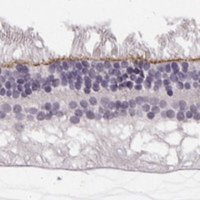 Anti-MPP5 antibody produced in rabbit