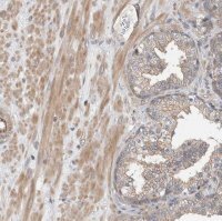 Anti-MPRIP antibody produced in rabbit