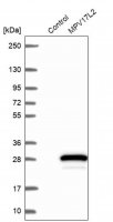 Anti-MPV17L2 antibody produced in rabbit HPA043111-100UL