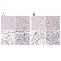 Anti-MRC1 antibody produced in rabbit
