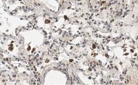 Anti-MRC1 Antibody, clone 1C9 ZooMAb� Rabbit Monoclonal 