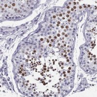 Anti-MRGBP antibody produced in rabbit