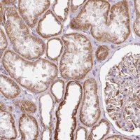 Anti-MRPL24 antibody produced in rabbit HPA054323-100UL