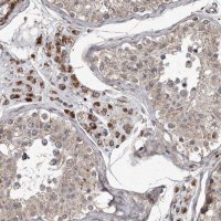 Anti-MRPS15 antibody produced in rabbit 