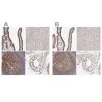 Anti-MSH6 antibody produced in rabbit 
