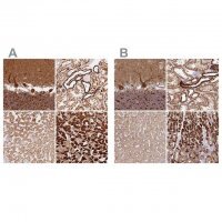 Anti-MT-CO2 antibody produced in rabbit HPA051505-100UL