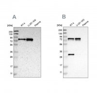 Anti-MTDH antibody produced in rabbit 