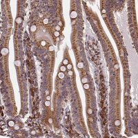 Anti-MTDH antibody produced in rabbit 