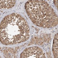 Anti-MTF1 antibody produced in rabbit 