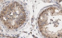 Anti-mTOR Antibody, clone 4O5 ZooMAb� Rabbit Monoclonal 