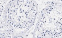 Anti-mTOR Antibody, clone 4O5 ZooMAb� Rabbit Monoclonal 
