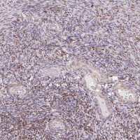 Anti-MUM1L1 antibody produced in rabbit 
