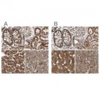 Anti-MUT antibody produced in rabbit 