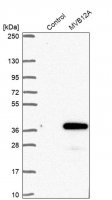 Anti-MVB12A antibody produced in rabbit