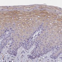 Anti-MVB12A antibody produced in rabbit