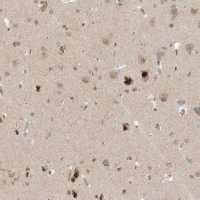 Anti-MXI1 antibody produced in rabbit 