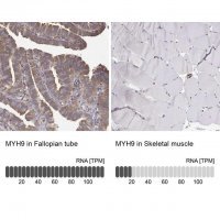 Anti-MYH9 HPA064783-100UL